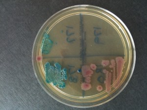 UrinaryIsolates